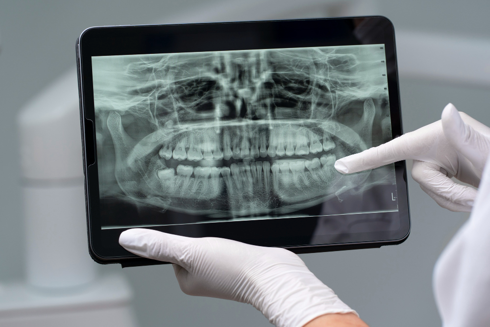 Digital X-Rays in Marlborough