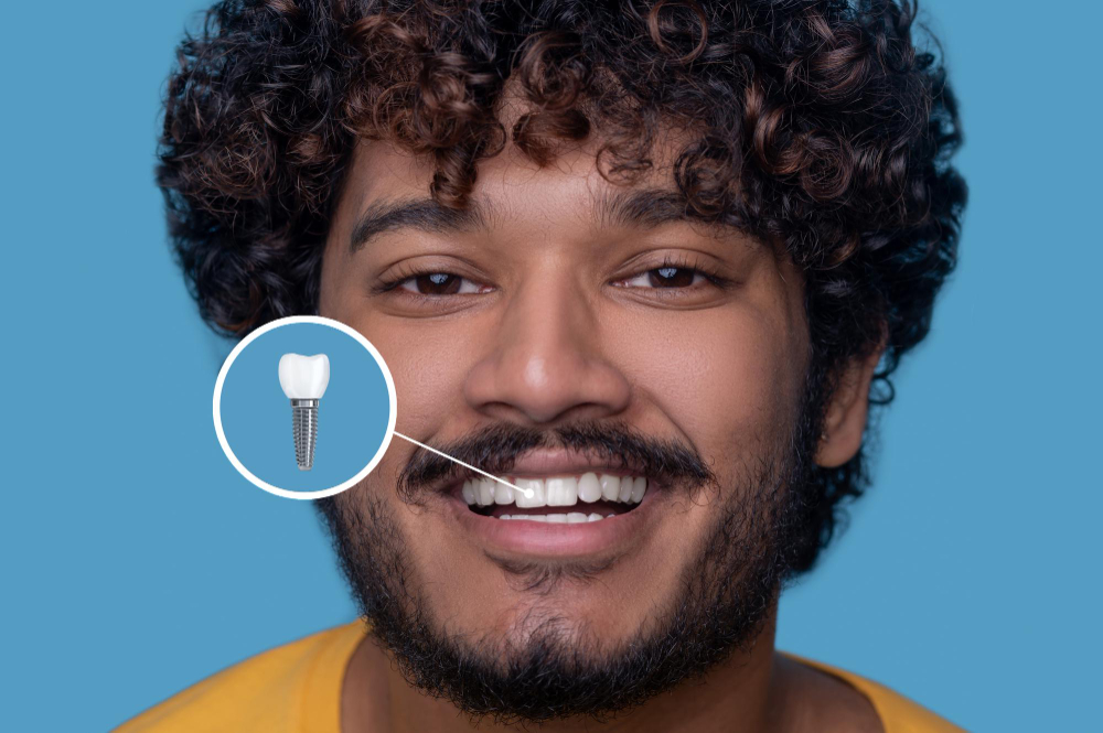 Implant Restoration in Marlborough