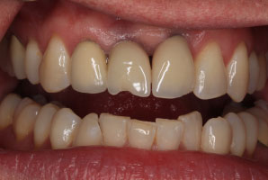 Before